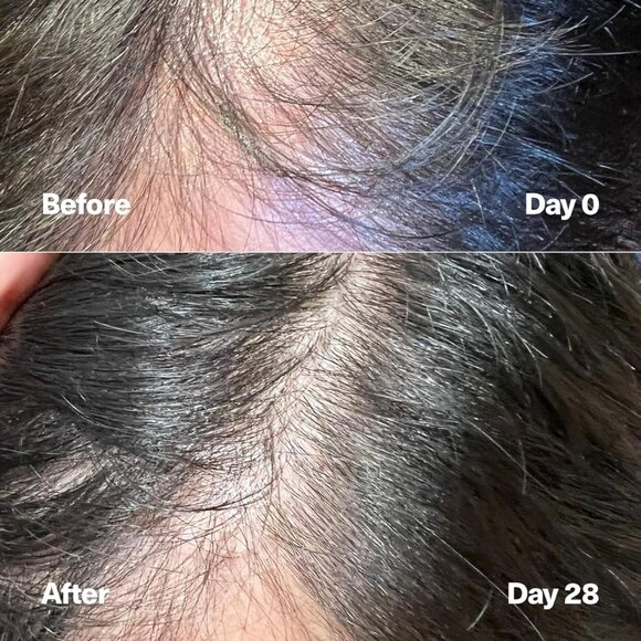 SickScience PowerCycle Scalp Treatment Serum – Hair Growth & Strength Booster - Picture 6 of 13